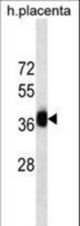 GBX2 Antibody western blot of human placenta tissue lysates (35 ug/lane). The GBX2 antibody detected the GBX2 protein (arrow).