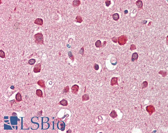 Anti-GBX2 antibody IHC staining of human brain, cortex. Immunohistochemistry of formalin-fixed, paraffin-embedded tissue after heat-induced antigen retrieval. Antibody LS-B10661 dilution 1:100.