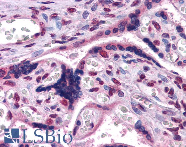 Anti-GBX2 antibody IHC of human placenta. Immunohistochemistry of formalin-fixed, paraffin-embedded tissue after heat-induced antigen retrieval. Antibody LS-B3947 concentration 3.75 ug/ml.