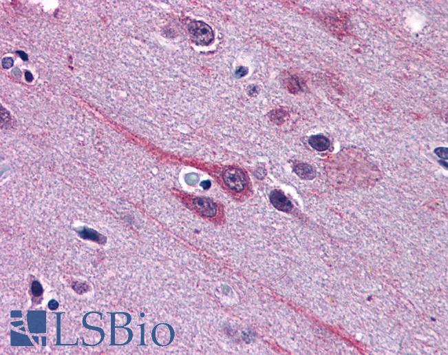 Anti-GBX2 antibody IHC of human brain, cortex. Immunohistochemistry of formalin-fixed, paraffin-embedded tissue after heat-induced antigen retrieval. Antibody LS-B3947 concentration 3.75 ug/ml.