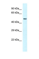 GC / VDBP antibody LS-C145619 Western blot of 721_B Cell lysate. Antibody concentration 1 ug/ml.