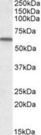 GC antibody (1 ug/ml) staining of Human Lung lysate (35 ug protein in RIPA buffer). Primary incubation was 1 hour. Detected by chemiluminescence.