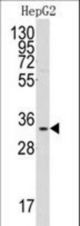 Western blot of anti-C1QBP Antibody in HepG2 cell line lysates (35 ug/lane). C1QBP(arrow) was detected using the purified antibody.