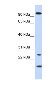 GUCA1A / GCAP1 antibody LS-C111552 Western blot of Fetal Kidney lysate.