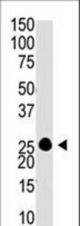 The anti-GCAP1 C-term antibody is used in Western blot to detect GCAP1 in Y79 cell lysate.