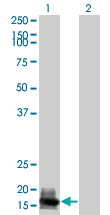 Western Blot analysis of GUCA1A expression in transfected 293T cell line by GUCA1A monoclonal antibody (M04), clone 2F7.Lane 1: GUCA1A transfected lysate(22.9 KDa).Lane 2: Non-transfected lysate.