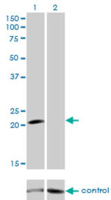 Western blot analysis of GUCA1A over-expressed 293 cell line, cotransfected with GUCA1A Validated Chimera RNAi (Lane 2) or non-transfected control (Lane 1). Blot probed with GUCA1A monoclonal antibody (M04), clone 2F7 . GAPDH ( 36.1 kDa ) used as specificity and loading control.