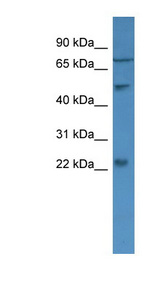 GUCA1B / GCAP2 antibody LS-C135613 Western blot of U937 cell lysate.