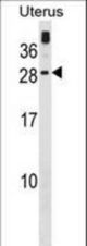 GUCA1C Antibody western blot of human Uterus tissue lysates (35 ug/lane). The GUCA1C antibody detected the GUCA1C protein (arrow).