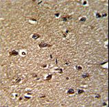 Formalin-fixed and paraffin-embedded human brain reacted with GCAT Antibody , which was peroxidase-conjugated to the secondary antibody, followed by DAB staining. This data demonstrates the use of this antibody for immunohistochemistry; clinical relevance has not been evaluated.