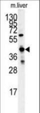 Western blot of GCAT antibody in mouse liver tissue lysates (35 ug/lane). GCAT (arrow) was detected using the purified antibody.