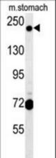 GCC2 Antibody western blot of mouse stomach tissue lysates (15 ug/lane). The GCC2 antibody detected GCC2 protein (arrow).