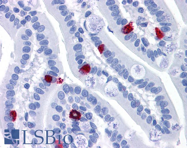 Anti-GCC2 antibody IHC of human small intestine. Immunohistochemistry of formalin-fixed, paraffin-embedded tissue after heat-induced antigen retrieval. Antibody LS-B4938 concentration 3.75 ug/ml.