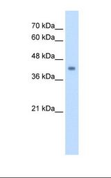 HepG2 cell lysate. Antibody concentration: 2.5 ug/ml. Gel concentration: 12%.