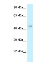COPS4 antibody LS-C145812 Western blot of Rat Lung lysate. Antibody concentration 1 ug/ml.