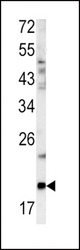 Western blot of GCG antibody in mouse bladder tissue lysates (35 ug/lane). GCG (arrow) was detected using the purified antibody.