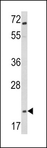 Western blot of Glucagon Antibody in Jurkat cell line lysates (35 ug/lane). GCG (arrow) was detected using the purified antibody.
