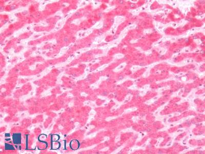 Human Liver: Formalin-Fixed, Paraffin-Embedded (FFPE)