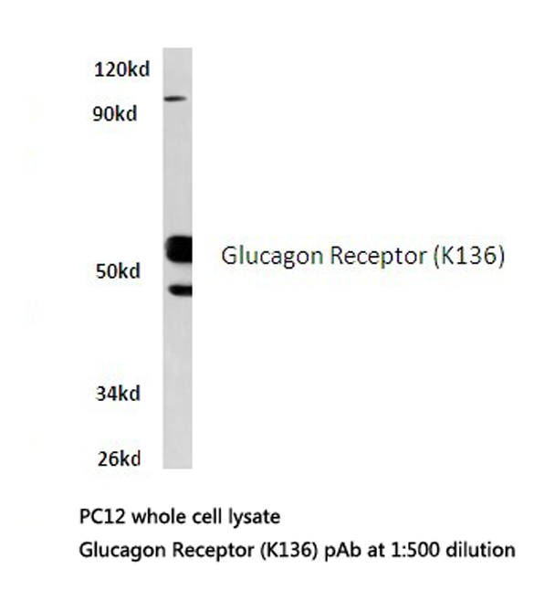 Western blot of Glucagon Receptor (K136) pAb in extracts from PC12 cells.