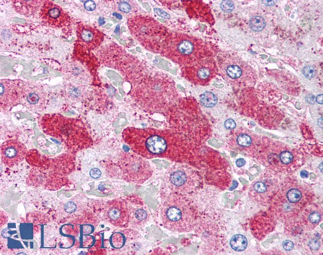 Anti-Glucagon Receptor antibody LS-A4258 IHC of human liver. Immunohistochemistry of formalin-fixed, paraffin-embedded tissue after heat-induced antigen retrieval.