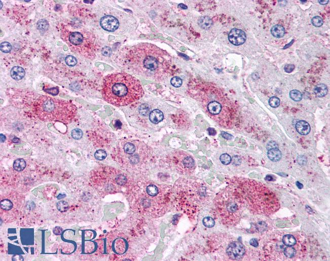 Anti-Glucagon Receptor antibody LS-A4256 IHC of human liver. Immunohistochemistry of formalin-fixed, paraffin-embedded tissue after heat-induced antigen retrieval.