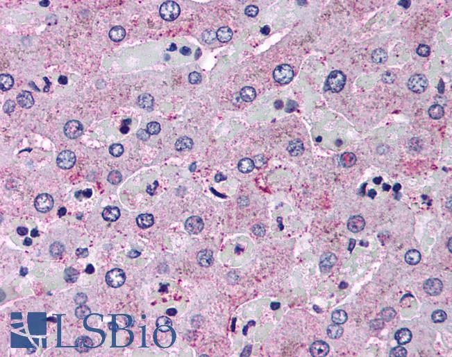 Anti-Glucagon Receptor antibody LS-A838 IHC of human liver. Immunohistochemistry of formalin-fixed, paraffin-embedded tissue after heat-induced antigen retrieval.
