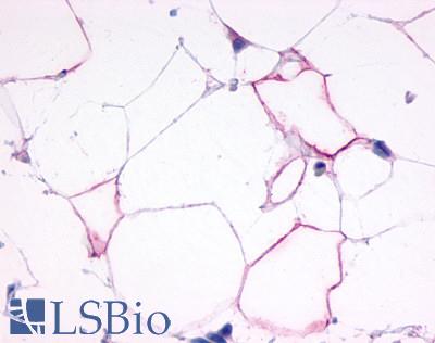 Anti-Glucagon Receptor antibody LS-A4257 IHC of human adipocytes. Immunohistochemistry of formalin-fixed, paraffin-embedded tissue after heat-induced antigen retrieval.