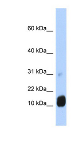 GCHFR antibody LS-C102041 Western blot of Fetal Liver lysate.