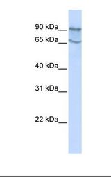 HepG2 cell lysate. Antibody concentration: 1.0 ug/ml. Gel concentration: 12%.