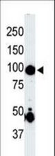 The anti-MAP4K2 antibody is used in Western blot to detect MAP4K2 in mouse skeletal muscle tissue lysate.