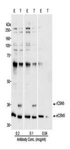 Detection of Human CSN5 by Western Blot. Samples: Whole cell lysate (50 ug - E; 25 ug - T) from HEK 293T cells that were mock transfected (E) or transfected with a CSN5 expression construct (T). Antibody: Affinity purified rabbit anti-CSN5 antibody used at the indicated concentrations. Detection: Chemiluminescence with a 10 second exposure.