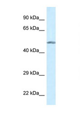 GCK / Glucokinase antibody LS-C145627 Western blot of COL0205 Cell lysate. Antibody concentration 1 ug/ml.
