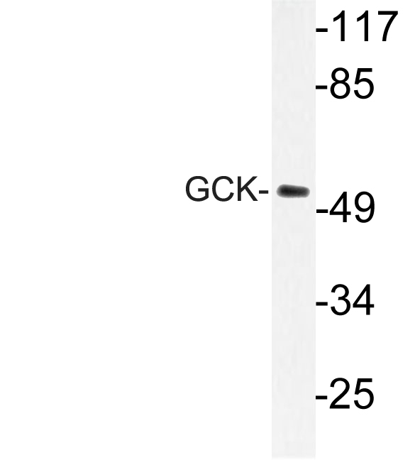 Western blot of GCK (R43) pAb in extracts from NIH-3T3 cells.