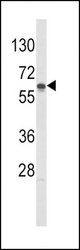 Western blot of hGCK-S418 in Jurkat cell line lysates (35 ug/lane). GCK (arrow) was detected using the purified antibody.