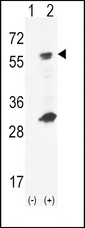 Western blot of GCK (arrow) using rabbit polyclonal hGCK-S418. 293 cell lysates (2 ug/lane) either nontransfected (Lane 1) or transiently transfected (Lane 2) with the GCK gene.