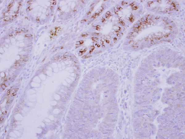 IHC of paraffin-embedded Normal Colon, using GCKR antibody at 1:500 dilution.