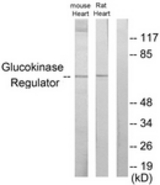 Western blot of extracts from mouse heart/rat heart cells, using Glucokinase Regulator Antibody. The lane on the right is treated with the synthesized peptide.