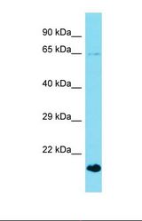 Western blot of Mouse Brain. Gckr antibody dilution 1.0 ug/ml.