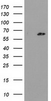 HEK293T cells were transfected with the pCMV6-ENTRY control (Left lane) or pCMV6-ENTRY GCKR (Right lane) cDNA for 48 hrs and lysed. Equivalent amounts of cell lysates (5 ug per lane) were separated by SDS-PAGE and immunoblotted with anti-GCKR.