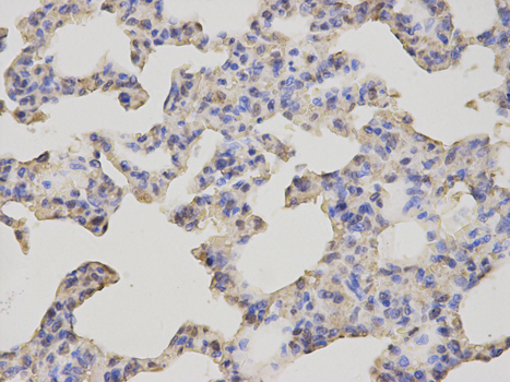 Immunohistochemistry of paraffin-embedded rat lung using GCLM antibody at dilution of 1:200 (400x lens).