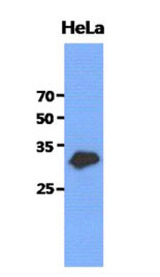 Western Blot: The cell lysates of HeLa (40 ug) were resolved by SDS-PAGE, transferred to PVDF membrane and probed with anti-human GCLM antibody (1:3000). Proteins were visualized using a goat anti-mouse secondary antibody conjugated to HRP and an ECL detection system.