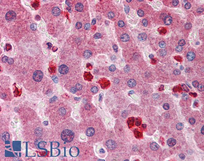 Anti-GCLM antibody IHC of human liver. Immunohistochemistry of formalin-fixed, paraffin-embedded tissue after heat-induced antigen retrieval. Antibody LS-B5848 concentration 5 ug/ml.