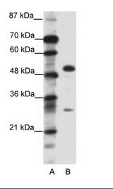 A: Marker, B: HepG2 Cell Lysate