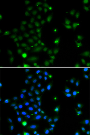 Immunofluorescence blot of MCF7 cell using GCM1 antibody. Blue: DAPI for nuclear staining.