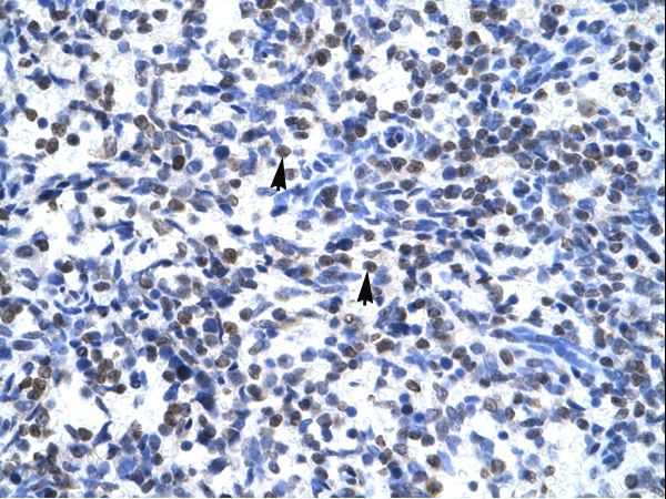 GCM1 antibody LS-C29803 was used in IHC to stain formalin-fixed, paraffin-embedded human spleen.