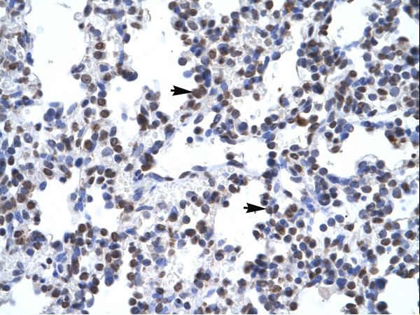 GCM1 antibody LS-C29803 was used in IHC to stain formalin-fixed, paraffin-embedded human lung.