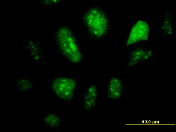 Immunofluorescence of monoclonal antibody to GCM1 on HeLa cell. [antibody concentration 10 ug/ml]
