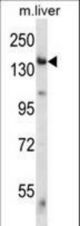 Mouse Eif2ak4 Antibody western blot of mouse liver tissue lysates (35 ug/lane). The Eif2ak4 antibody detected the Eif2ak4 protein (arrow).