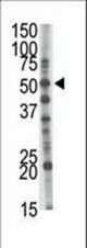 The anti-GCNT1 antibody is used in Western blot to detect GCNT1 in mouse kidney tissue lysate.