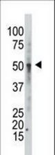 Western blot of anti-GCNT1 Antibody in CEM cell line lysates (35 ug/lane). GCNT1 (arrow) was detected using the purified antibody.